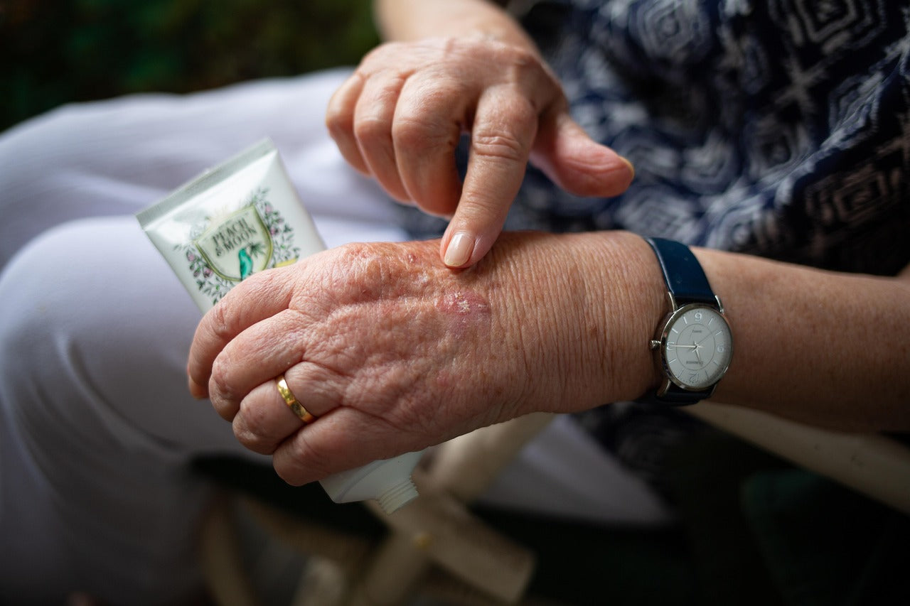 Tea & Gout: Friend or Foe? What You Need to Know